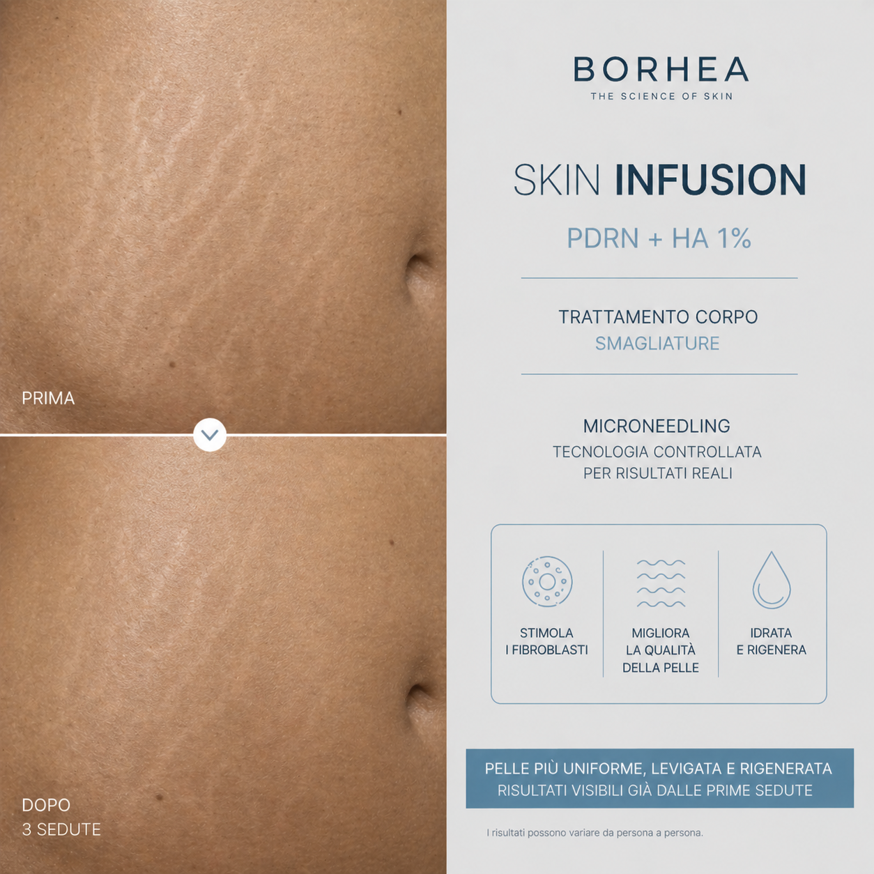 BORHEA SKIN INFUSION PDRN + HA 1% – 5x5 ml - immagine 7